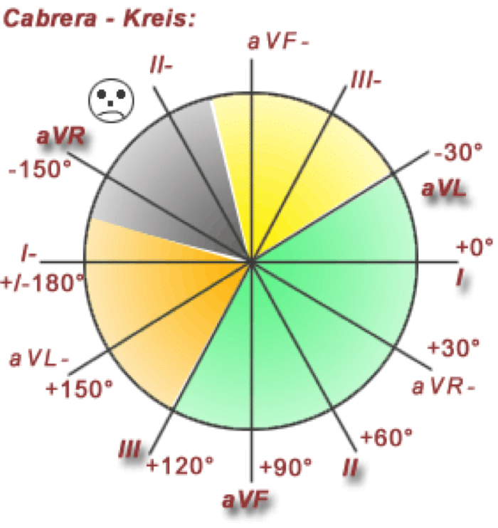 cabrera cirkeln är ett verktyg för att bestämma elaxeln på ekg