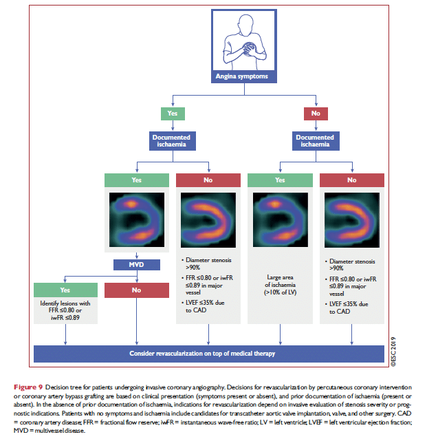 ESC flowchart för beslutsfattning om revaskularisering hos patienter med kronisk koronart synrom (stabil angina)