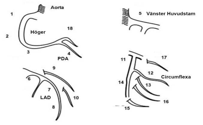 Nomenklatur som används vid koronarangiografi på svenska PCI-lab för beteckning av kranskärl segment i SCAAR/Swedeheart