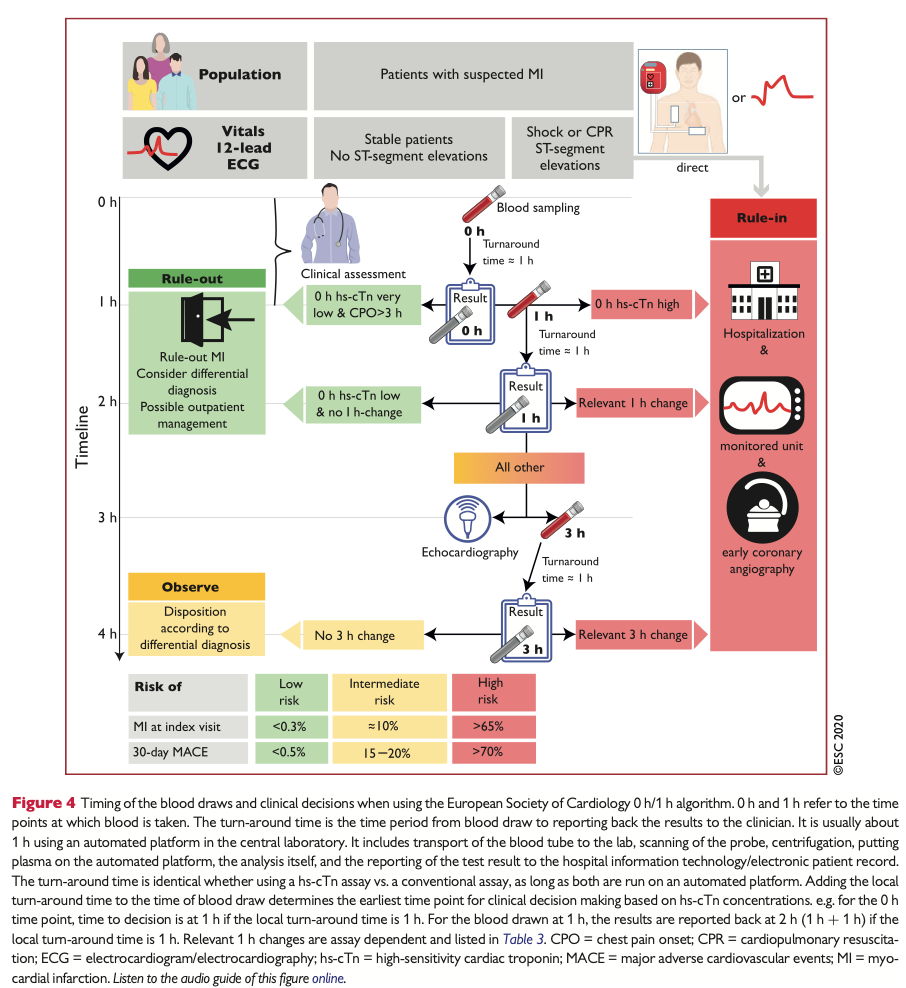 flowchart blodbprover vid nstemi/instabil angina