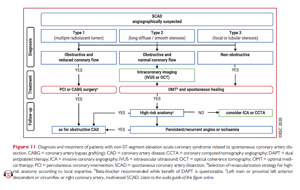 ESC flowchart utredning och behandling SCAD (spontan kranskärlsdissektion) 2020