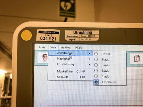 Inställning på EKG-apparaten för esophagus-EKG