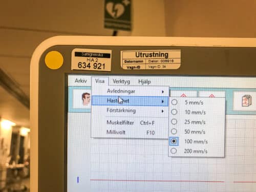 Inställning av unskrivningshastighet på EKG-apparaten för esophagus-EKG