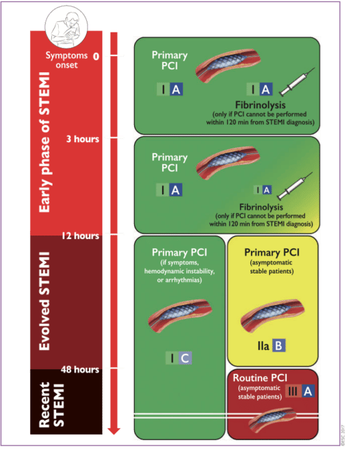 Schema Reperfusionsstrategier vid STEMI, primär PCI vs trombolys