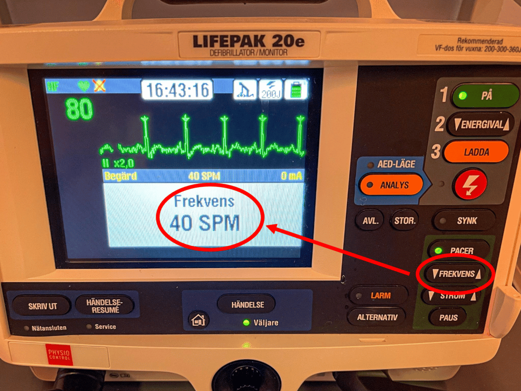 välj frekvensen på pacemakern