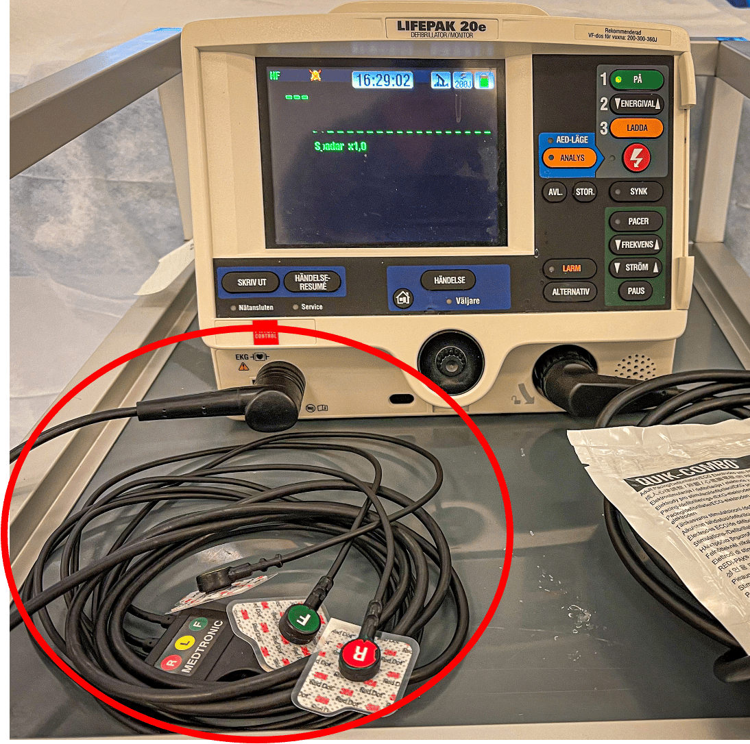Temporär Pacemaker (transkutan, transvenös) - Kardiologi.se