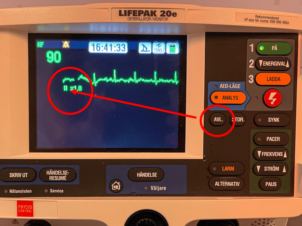 välj en av extremitets-avledningar på defibrillatorn