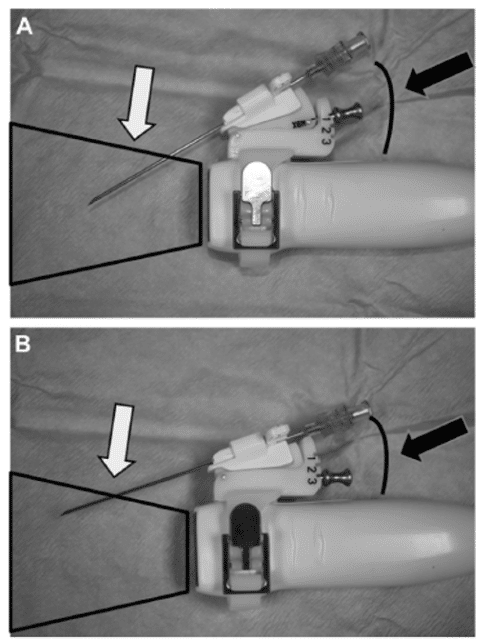 needle guide på ultraljudsprobe