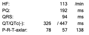 ekg siffror exempel