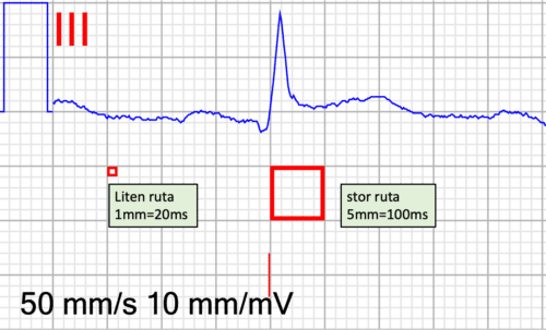 EKG skriven i 50mm/sek, små och stor rutor