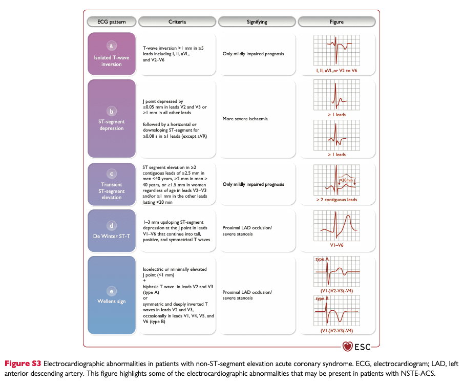 EKG vid NSTEMI