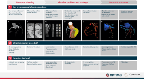 fördelar med CT-guidad PCI